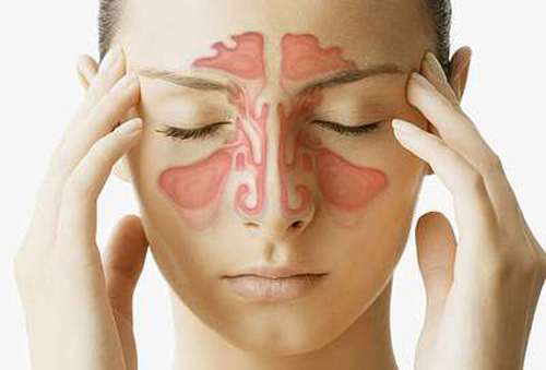 Bệnh viêm mũi dị ứng thường để lại những hậu quả khó lường