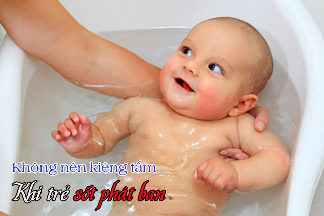 Việc tắm khi trẻ bị sốt phát ban là cần thiết