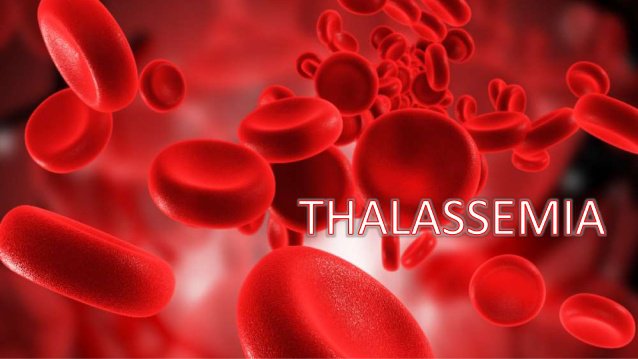 Trình Dược viên chia sẻ về bệnh thiếu máu Thalassemia