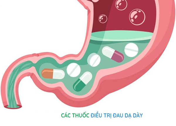 Tìm hiểu một số nhóm thuốc phổ biến giúp điều trị bệnh dạ dày