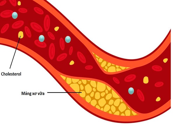 <center><em>Điều trị bệnh tăng cholesterol máu tiên phát và loạn lipid huyết hỗn hợp</em></center>